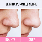 Eelhoe - Masca Puncte Negre